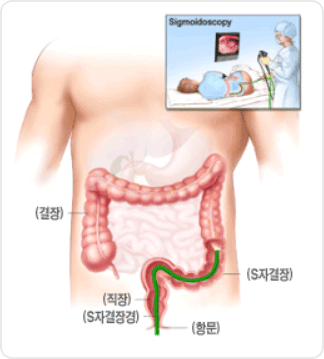 ���峻�ð� �˻�